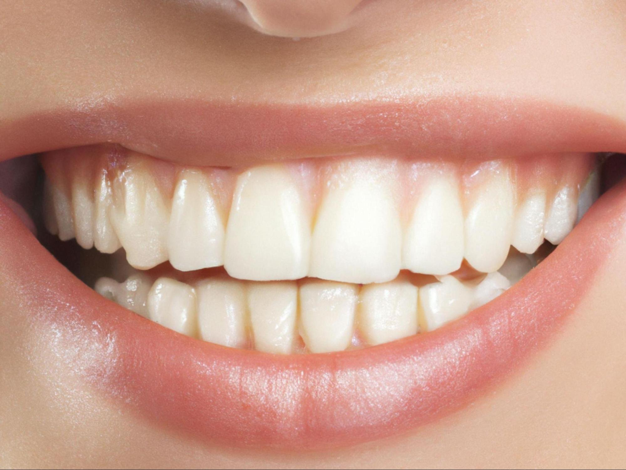 transform-your-confidence-with-cosmetic-dentistry